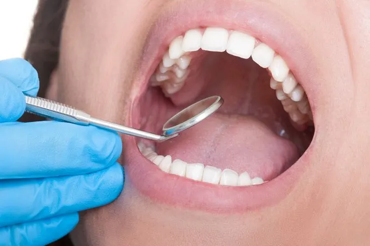 Relieving tooth nerve pain
