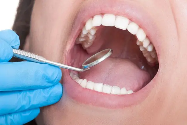 Tooth nerve inflammation