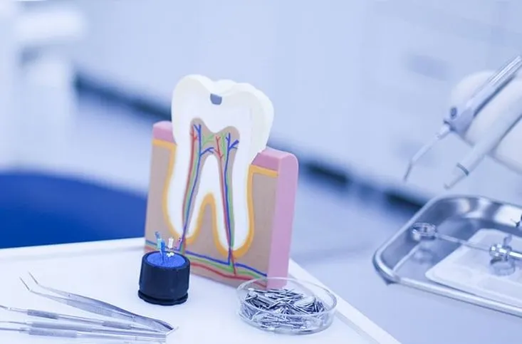 Tooth nerve treatment