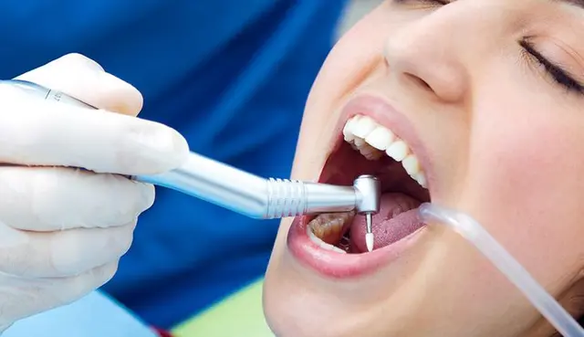 Tooth nerve treatment