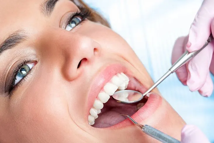 حشوات تجميلية للاسنان الامامية