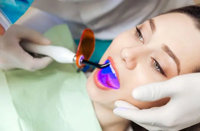 Do cosmetic fillings fall out?